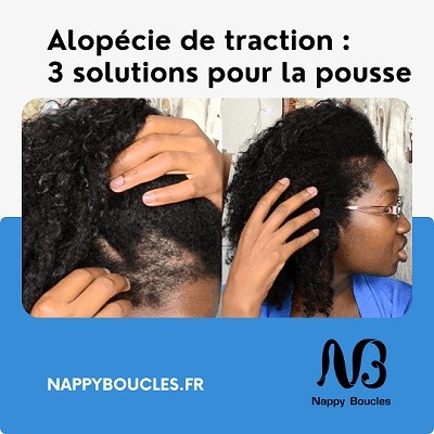 Vapo - Nappy N'ko : Conseils, astuces pour cheveux crépus, frisés
